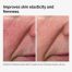 100pct-fermented-rose-hip-before-after-elasticity_1