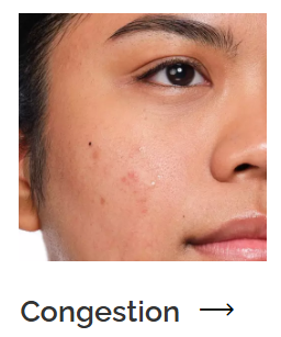 Redness skincare