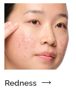 Congestion skincare