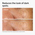 ord-alpha-arbutin-before-after-dark-spots