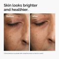 ord-mars-before-after-healthy