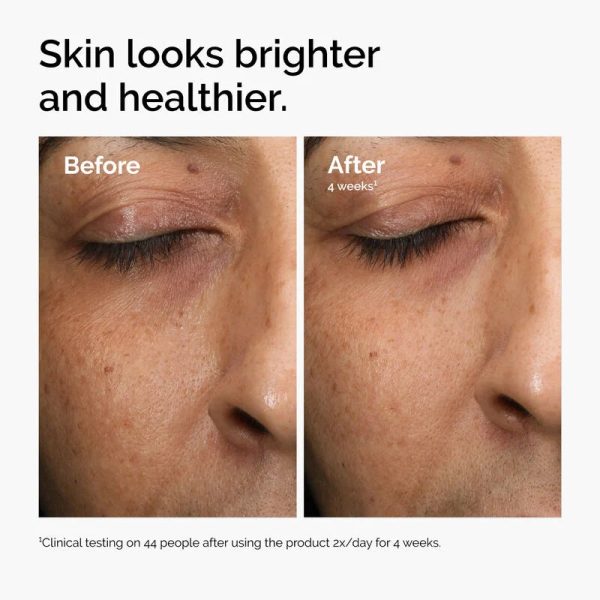 ord-mars-before-after-healthy