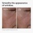 ord-multi-peptide-ha-serum-wrinkles-before-after