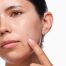 rdn-the-acne-set-application